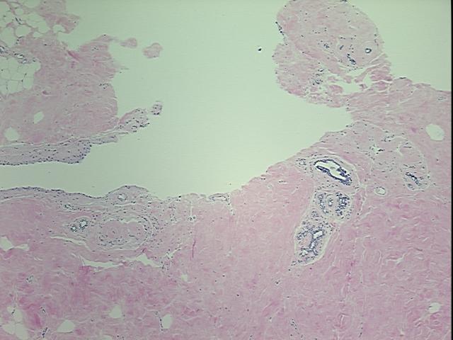4x Image
