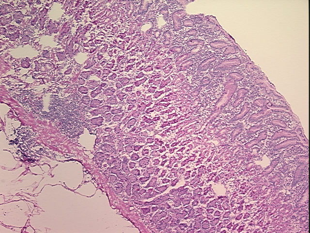 4x Image