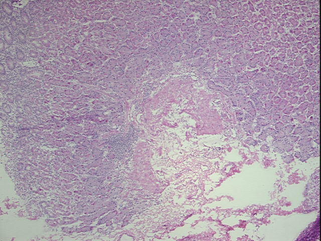 4x Image