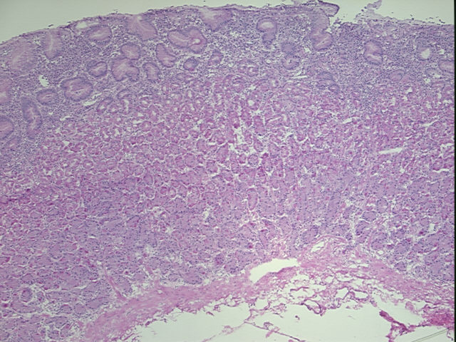 4x Image