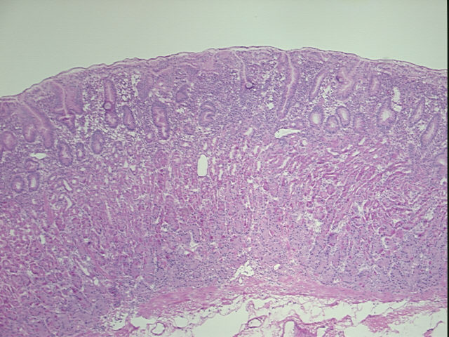 4x Image
