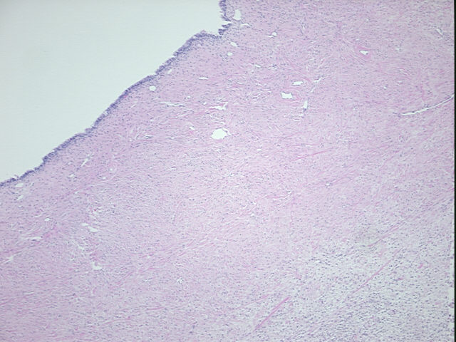 4x Image