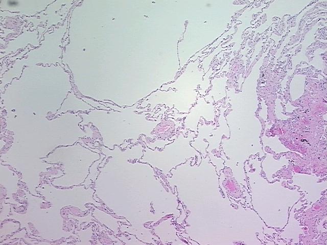 4x Image