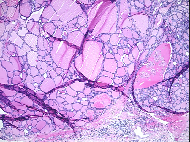 4x Image
