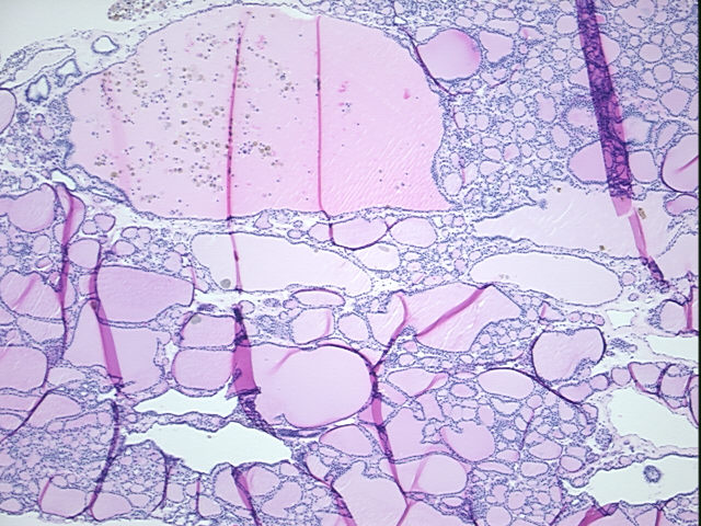4x Image