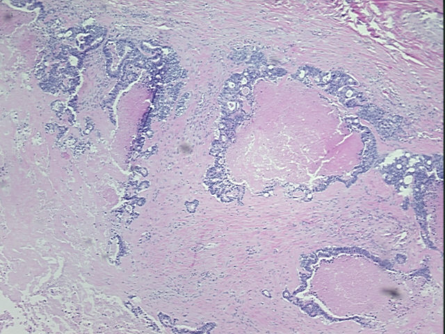 4x Image