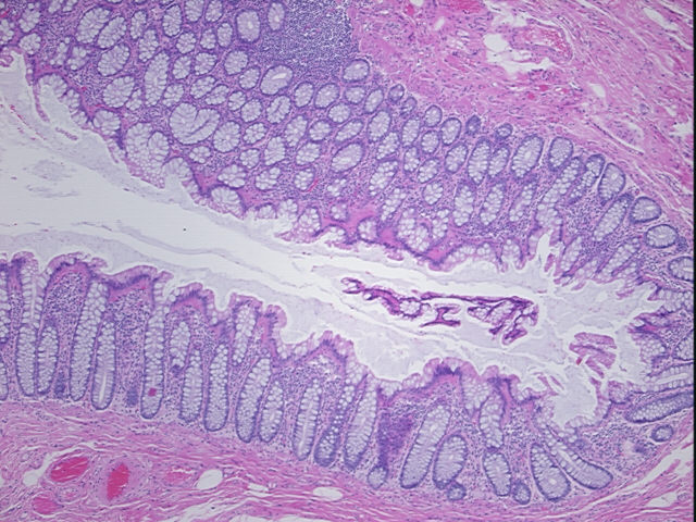 4x Image