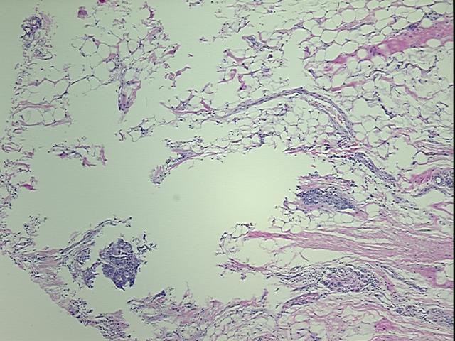 4x Image