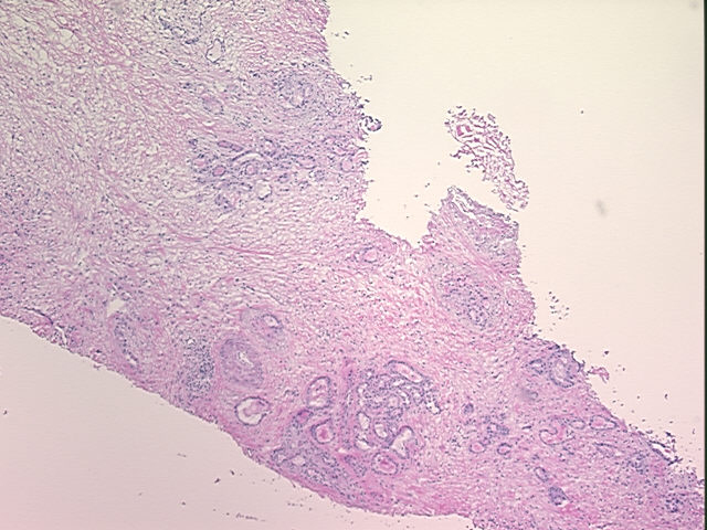 4x Image
