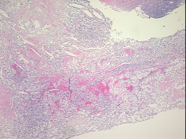 4x Image