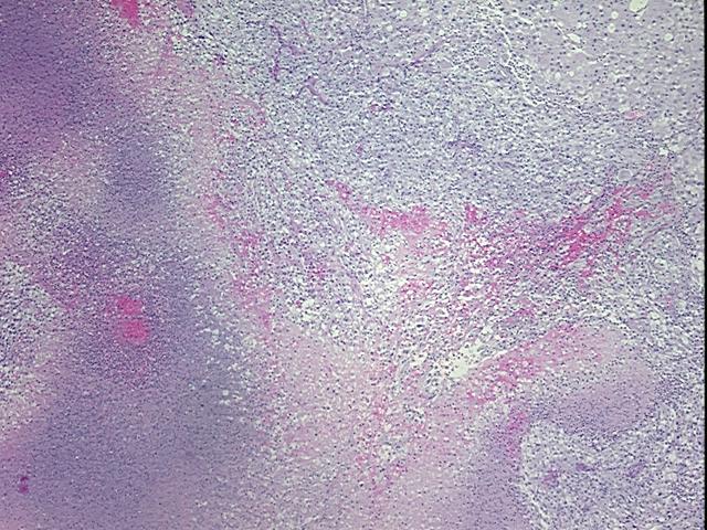 4x Image