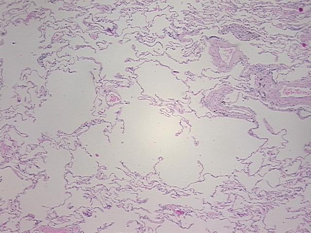 4x Image