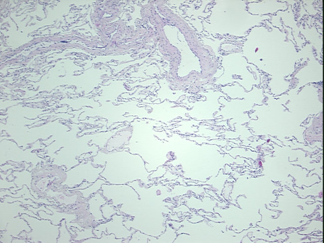 4x Image