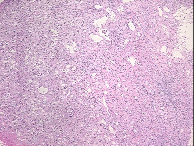 4x Image