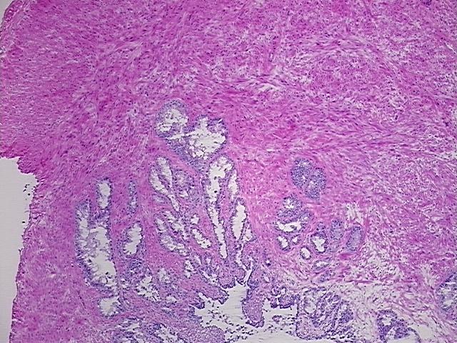 4x Image