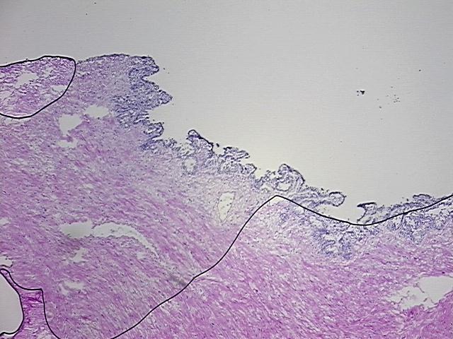 4x Image