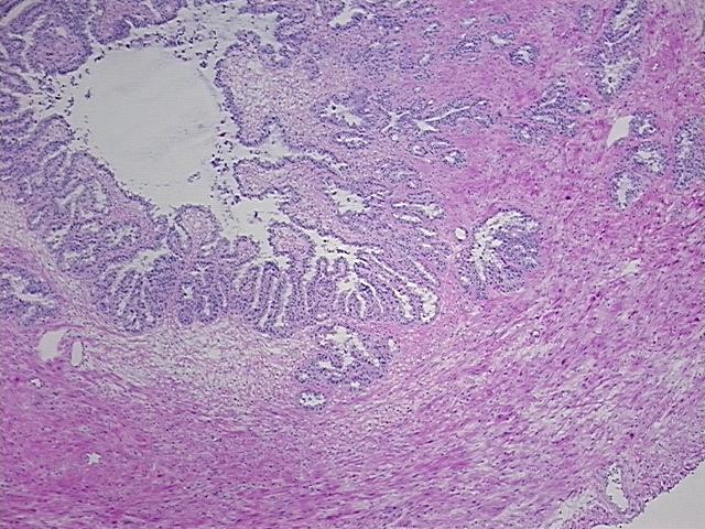 4x Image