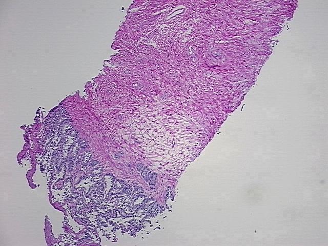 4x Image