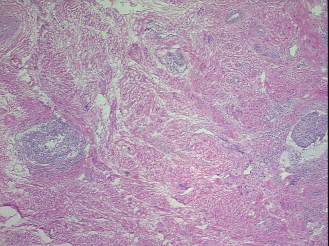 4x Image