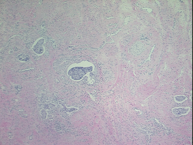 4x Image