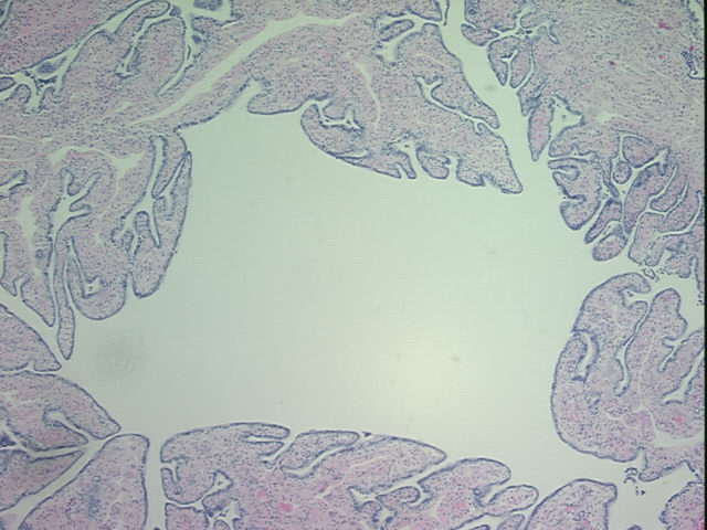 4x Image