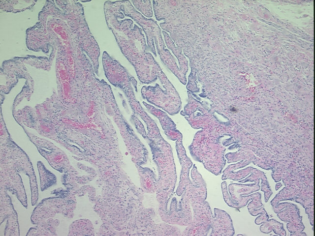 4x Image