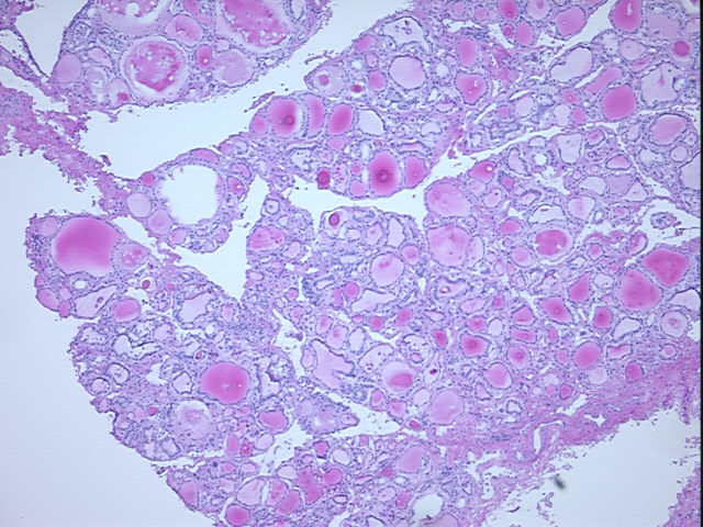 Frozen Tissue Sections, Thyroid gland
