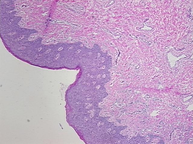 4x Image