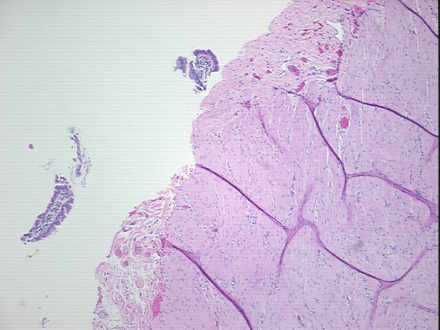 4x Image