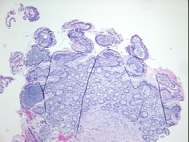 4x Image