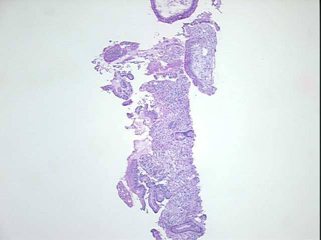 4x Image