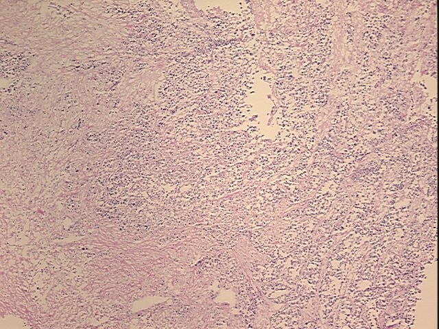 4x Image