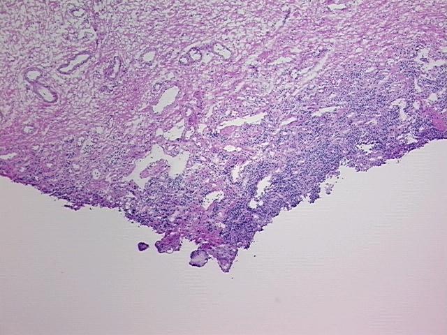4x Image