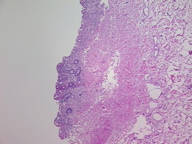 4x Image