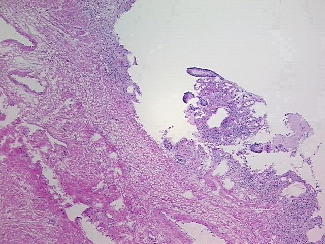 4x Image