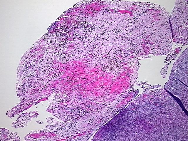 4x Image
