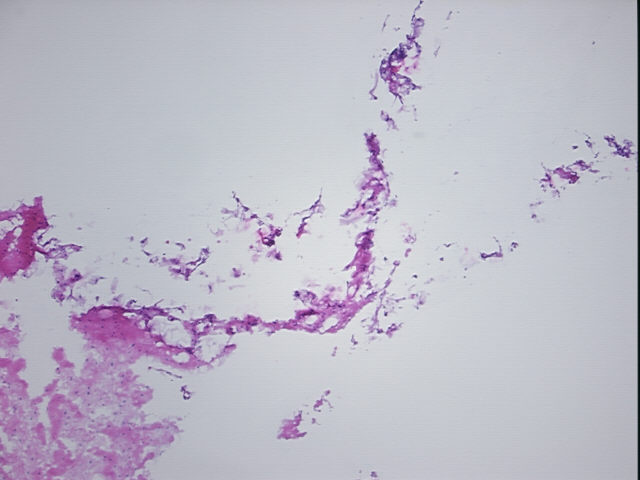4x Image