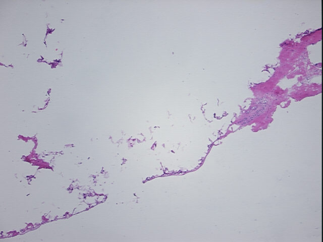 4x Image