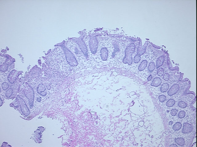 4x Image