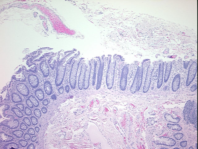 4x Image