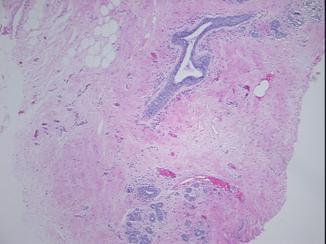 4x Image