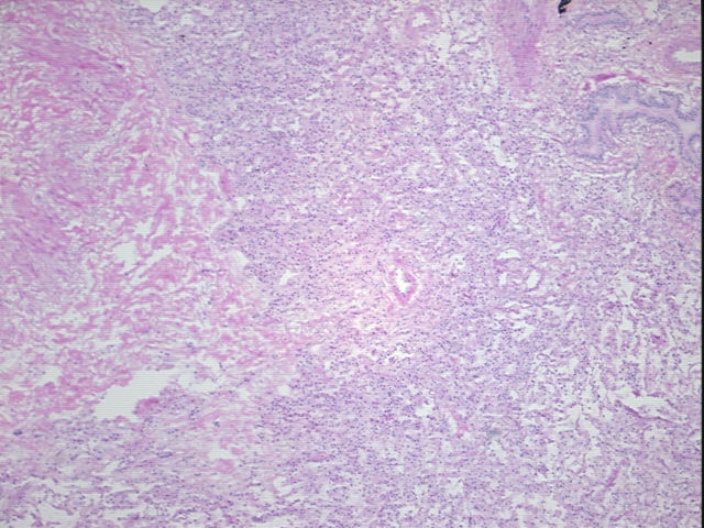 4x Image