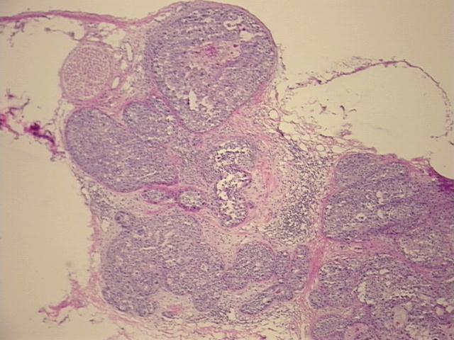 4x Image