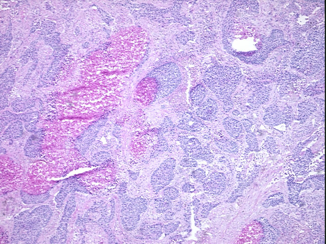 4x Image