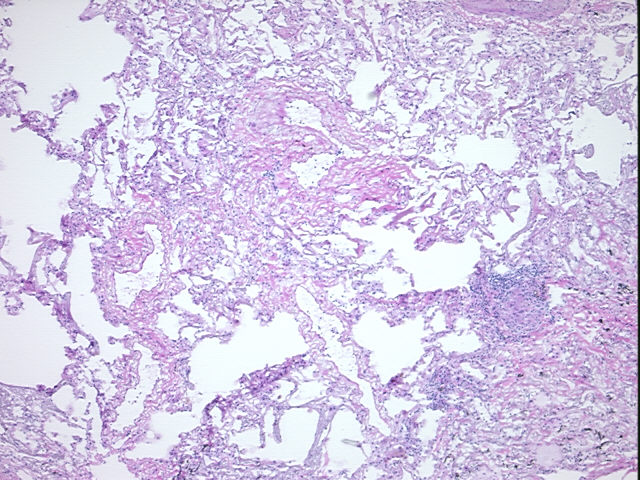 4x Image