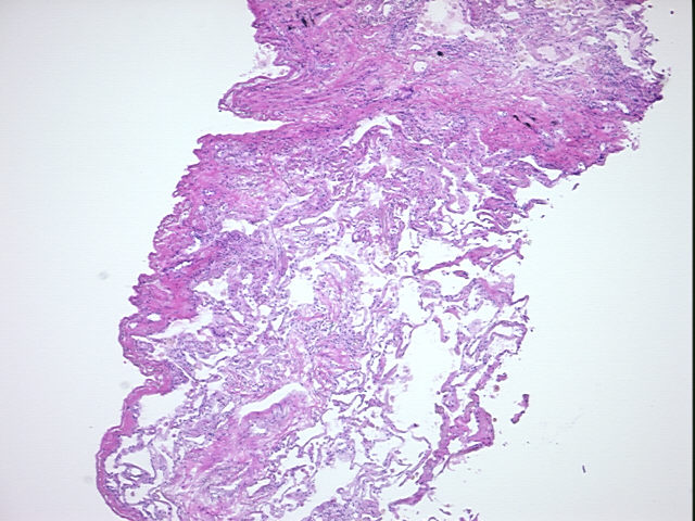 4x Image
