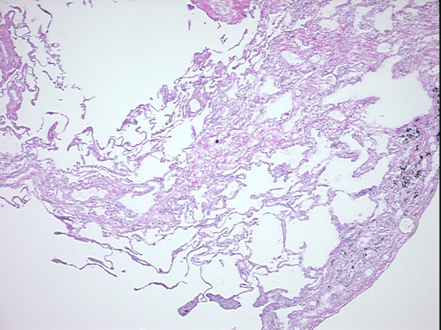 4x Image