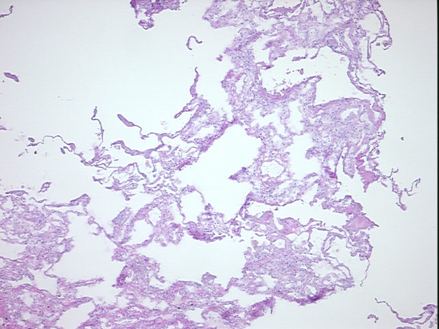 4x Image
