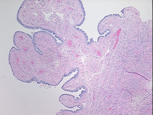 4x Image