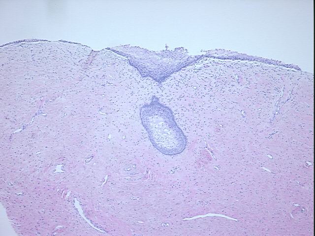 4x Image